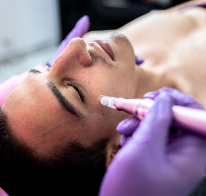 Pulizia e Peeling
